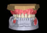 design digital total prostheses using exocad